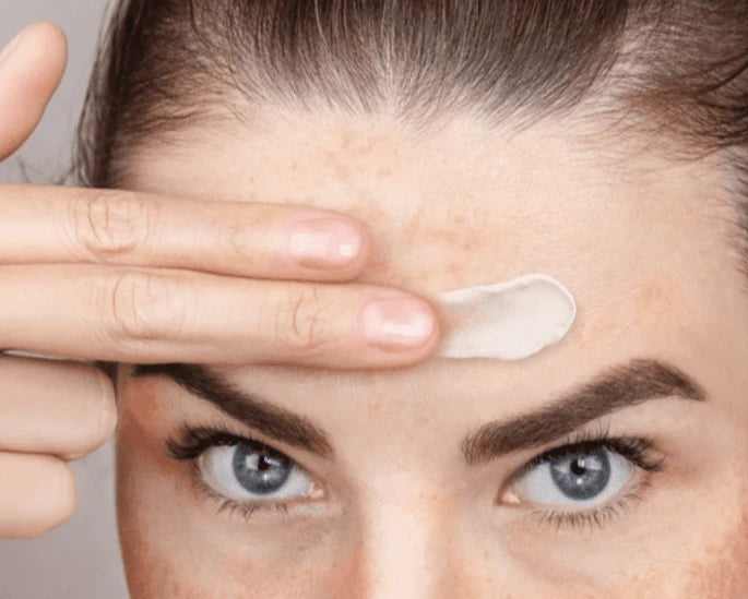 Aichun Beauty - Dark Spot Removal Cream