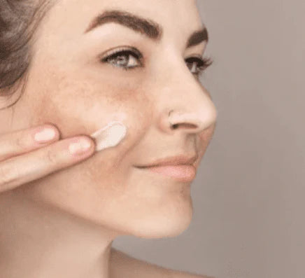 Aichun Beauty - Dark Spot Removal Cream